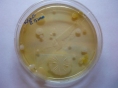 Полужидкий агар для хранения культур микроорганизмов (проб. 10 мл б/пробки)