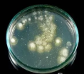 274720 Сабуро агар модифицированный, Для выделения и культивирования дерматофитов и других патогенных грибов при нейтральном рН